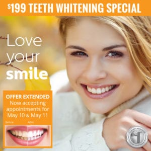Professional In-Office Teeth Whitening for $199